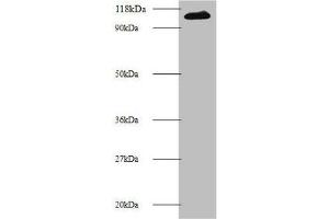 Western blot All lanes: MIB1 antibody at 2 μg/mL + 293T whole cell lysate Secondary Goat polyclonal to rabbit IgG at 1/10000 dilution Predicted band size: 111 kDa Observed band size: 111 kDa (MIB1 抗体  (AA 5-332))
