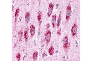 Immunohistochemistry (Formalin/PFA-fixed paraffin-embedded sections) of human brain, neurons and glia with GPR3 polyclonal antibody . (GPR3 抗体  (2nd Extracellular Domain))