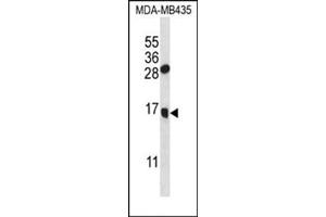 Western blot analysis in MDA-MB435 cell line lysates (35 ug/lane) using GNLY Antibody (C-term) Cat.