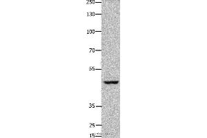 Western blot analysis of Hela cell, using FOXD3 Polyclonal Antibody at dilution of 1:450 (FOXD3 抗体)
