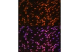 Immunofluorescence analysis of C6 cells using FUBP1 antibody (ABIN6130392, ABIN6140802, ABIN6140804 and ABIN6221231) at dilution of 1:100. (FUBP1 抗体  (AA 302-644))