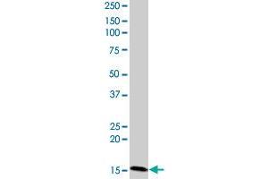 CIDEC monoclonal antibody (M07), clone 2E2. (CIDEC 抗体  (AA 53-141))