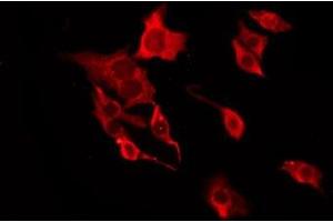 ABIN6277679 staining HT29 by IF/ICC. (Serotonin Receptor 3A 抗体  (Internal Region))
