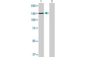 Western Blot analysis of TYK2 expression in transfected 293T cell line by TYK2 MaxPab polyclonal antibody. (TYK2 抗体  (AA 1-1187))