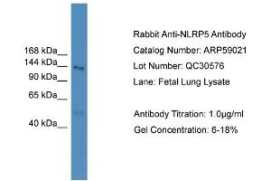 WB Suggested Anti-NLRP5  Antibody Titration: 0. (NLRP5 抗体  (N-Term))