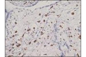 Immunohistochemistry (IHC) image for anti-CD163 (CD163) (N-Term) antibody (ABIN870406) (CD163 抗体  (N-Term))