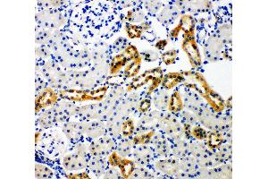 Anti-NADPH oxidase 4 antibody, IHC(P) IHC(P): Rat Kidney Tissue (NADPH Oxidase 4 抗体  (C-Term))
