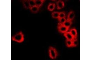 Immunofluorescent analysis of GBL staining in MCF7 cells. (GBL 抗体)