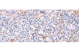 Immunohistochemistry of paraffin-embedded Human tonsil tissue using FUCA2 Polyclonal Antibody at dilution of 1:70(x200) (FUCA2 抗体)