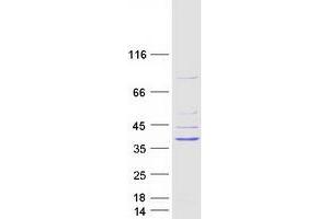 Validation with Western Blot (GTPase, IMAP Family Member 1 (GIMAP1) protein (Myc-DYKDDDDK Tag))