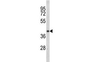 Western blot analysis of CCR3 antibody and Jurkat lysate. (CCR3 抗体  (AA 291-318))