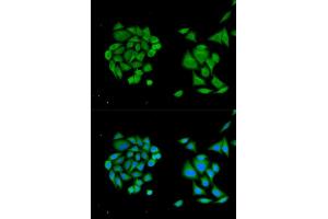Immunofluorescence (IF) image for anti-DEAD (Asp-Glu-Ala-Asp) Box Polypeptide 58 (DDX58) (C-Term) antibody (ABIN3023649)