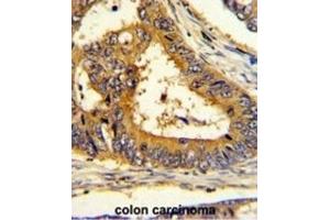 Immunohistochemistry (IHC) image for anti-SREBF chaperone (SCAP) antibody (ABIN3003807) (SREBF chaperone 抗体)
