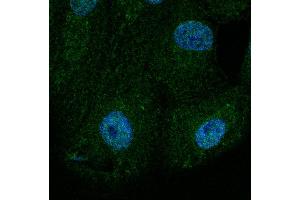 Immunofluorescence - anti-BAX Ab at 1/100 dilution in NHl/3T3 cells, cells were fixed with methanol and permeabilized With 0. (BAX 抗体  (N-Term))