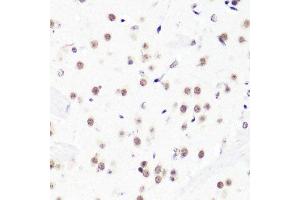 Immunohistochemistry (Paraffin-embedded Sections) (IHC (p)) image for anti-Histone 3 (H3) (H3R2me2) antibody (ABIN3017480)