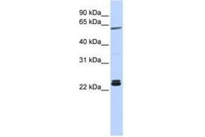 Image no. 1 for anti-H1 Histone Family, Member 0 (H1F0) (AA 36-85) antibody (ABIN6741265) (Histone H1 抗体  (AA 36-85))