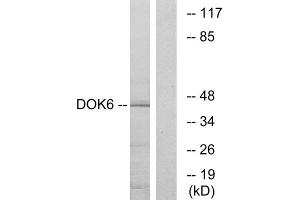 Western blot analysis of extracts from COLO cells, using DOK6 antibody. (DOK6 抗体  (Internal Region))
