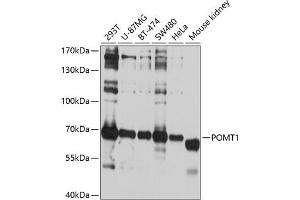Western blot analysis of extracts of various cell lines, using POMT1 antibody (ABIN6132825, ABIN6145953, ABIN6145954 and ABIN6214473) at 1:1000 dilution. (POMT1 抗体  (AA 310-550))