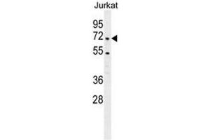 PRMT4 Antibody(Center) western blot analysis in Jurkat cell line lysates (35µg/lane).