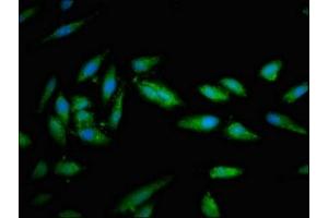 Immunofluorescent analysis of Hela cells using ABIN7171253 at dilution of 1:100 and Alexa Fluor 488-congugated AffiniPure Goat Anti-Rabbit IgG(H+L) (STXBP1 抗体  (AA 245-594))