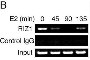 Image no. 1 for anti-PR Domain Containing 2, with ZNF Domain (PRDM2) antibody (ABIN2995299) (PRDM2 抗体)