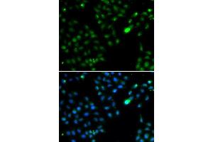 Immunofluorescence analysis of HeLa cells using FKBP3 antibody. (FKBP3 抗体  (AA 1-224))