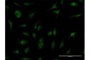 Immunofluorescence (IF) image for anti-TBC1 (Tre-2/USP6, BUB2, Cdc16) Domain Family, Member 1 (TBC1D1) (AA 1-1168) antibody (ABIN525034)