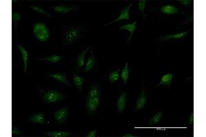 Immunofluorescence of purified MaxPab antibody to TBC1D1 on HeLa cell. (TBC1D1 抗体  (AA 1-1168))