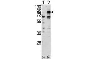 Western blot analysis of CPT1B antibody and 293 cell lysate either nontransfected (Lane 1) or transiently transfected with the CPT1B gene (2). (CPT1B 抗体  (AA 606-637))