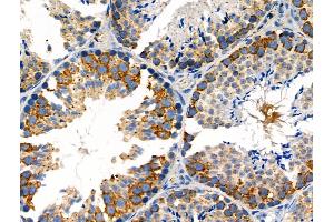 Phospho-MEKK1 (Thr1400) Antibody at 1/100 staining Mouse testis tissue by IHC-P. (MAP3K1 抗体  (pThr1400))