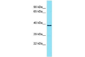 Host: Rabbit Target Name: TMEM121 Sample Type: ACHN Whole Cell lysates Antibody Dilution: 1. (TMEM121 抗体  (N-Term))
