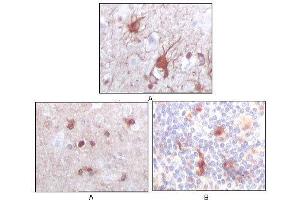 Immunohistochemical analysis of paraffin-embedded human brain (A) and human thymus tissues (B), showing cytoplasmic localization using S100B mouse mAb with DAB staining. (S100B 抗体)