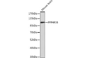 Western blot analysis of extracts of Mouse testis, using PPP4R3B Rabbit pAb (ABIN7270374) at 1:500 dilution. (SMEK2 抗体  (AA 628-817))