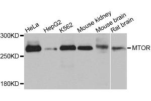 Western blot analysis of extracts of various cells, using MTOR antibody. (MTOR 抗体)