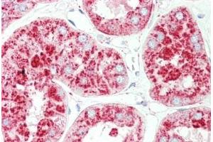 Human Kidney: Formalin-Fixed, Paraffin-Embedded (FFPE) (LAMP1 抗体)