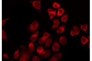 Immunofluorescence (fixed cells) (IF/ICC) image for anti-Activating Transcription Factor 2 (ATF2) (pSer44), (pSer62) antibody (ABIN6255342)