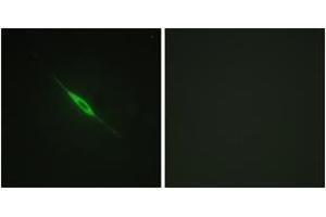Immunofluorescence analysis of NIH-3T3 cells, using PKC delta (Phospho-Tyr52) Antibody. (PKC delta 抗体  (pTyr52))