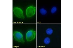 ABIN185577 Immunofluorescence analysis of paraformaldehyde fixed MCF7 cells, permeabilized with 0. (ADRA2A 抗体  (Internal Region))