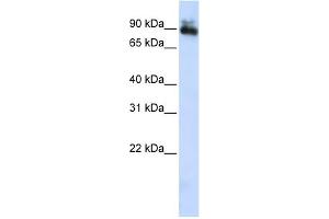 WB Suggested Anti-SP4 Antibody Titration:  0. (SP4 抗体  (Middle Region))