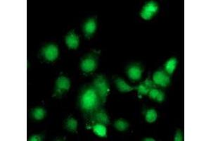 Anti-C1S mouse monoclonal antibody (ABIN2455521) immunofluorescent staining of COS7 cells transiently transfected by pCMV6-ENTRY C1S (RC218963). (C1S 抗体)