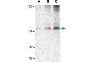 Western blot analysis of TANK in Daudi cell lysate with TANK polyclonal antibody  at (A) 0. (TANK 抗体  (C-Term))