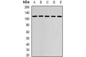 Western blot analysis of DHTKD1 expression in MCF7 (A), HepG2 (B), mouse brain (C), mouse kidney (D), rat liver (E) whole cell lysates. (DHTKD1 抗体)