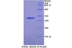 Non Metastatic Cells 6, Protein Expressed In protein