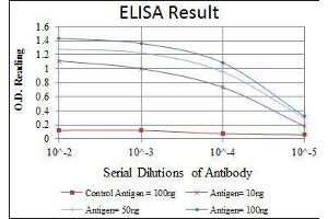 Red: Control Antigen (100 ng), Purple: Antigen (10 ng), Green: Antigen (50 ng), Blue: Antigen (100 ng), (ATF2 抗体)