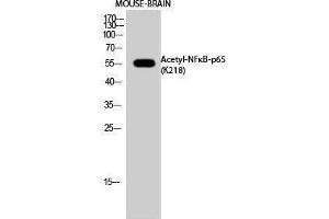 Western Blotting (WB) image for anti-Nuclear Factor-kB p65 (NFkBP65) (acLys218) antibody (ABIN3172840) (NF-kB p65 抗体  (acLys218))