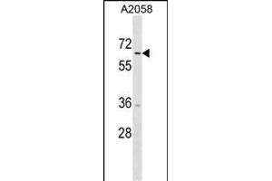 TRIM35 Antibody (C-term) (ABIN1537330 and ABIN2850370) western blot analysis in  cell line lysates (35 μg/lane). (TRIM35 抗体  (C-Term))