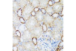 Immunohistochemistry of paraffin-embedded mouse kidney using NEFH antibody at dilution of 1:100 (x40 lens).