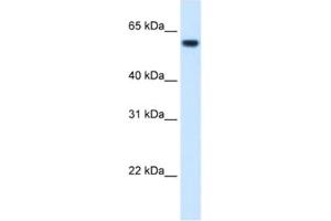 Western Blotting (WB) image for anti-Formiminotransferase Cyclodeaminase (FTCD) antibody (ABIN2462433) (FTCD 抗体)