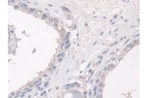 Detection of HPS4 in Human Prostate Tissue using Polyclonal Antibody to Hermansky Pudlak Syndrome Protein 4 (HPS4)