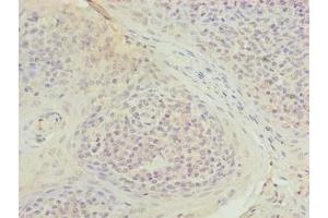 Immunohistochemistry of paraffin-embedded human tonsil tissue using ABIN7173675 at dilution of 1:100 (TUBB1 抗体  (AA 270-451))